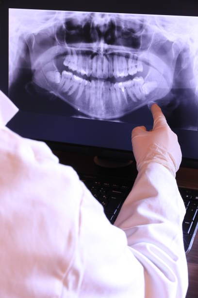 Best Emergency Root Canal Treatment in National Park, NJ