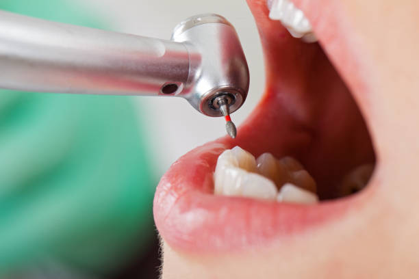 Best Weekend Emergency Dentist in National Park, NJ